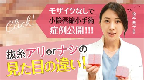 まんこ 整形|小陰唇縮小術｜びらびらを切除する婦人科形成｜新宿駅前婦人科 